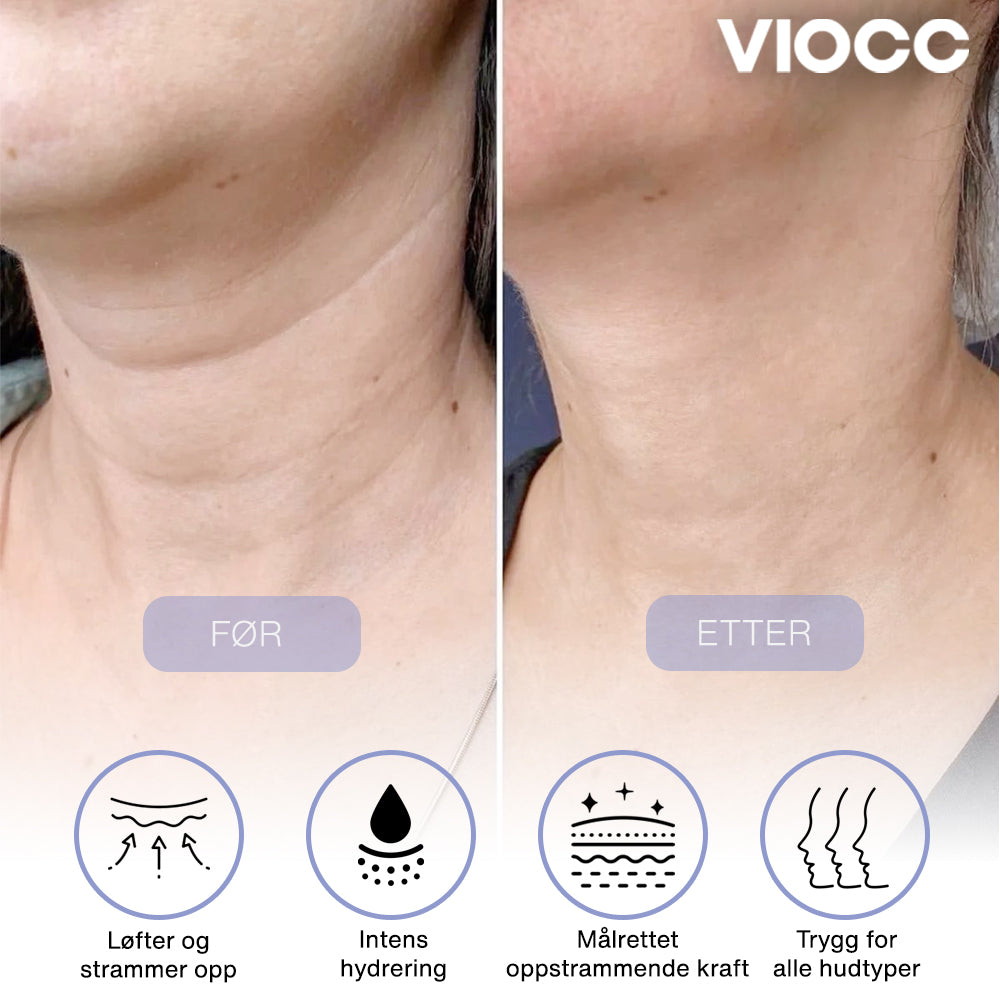 VIOCC™ Stram & Løft Nakekrem