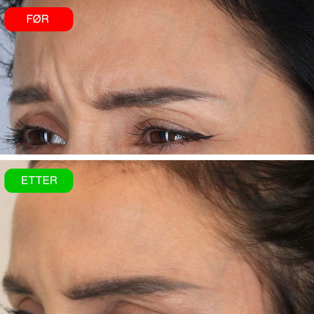 VIOCC™ Blå Kobber Peptid Fasthet Anti-Rynke Serum