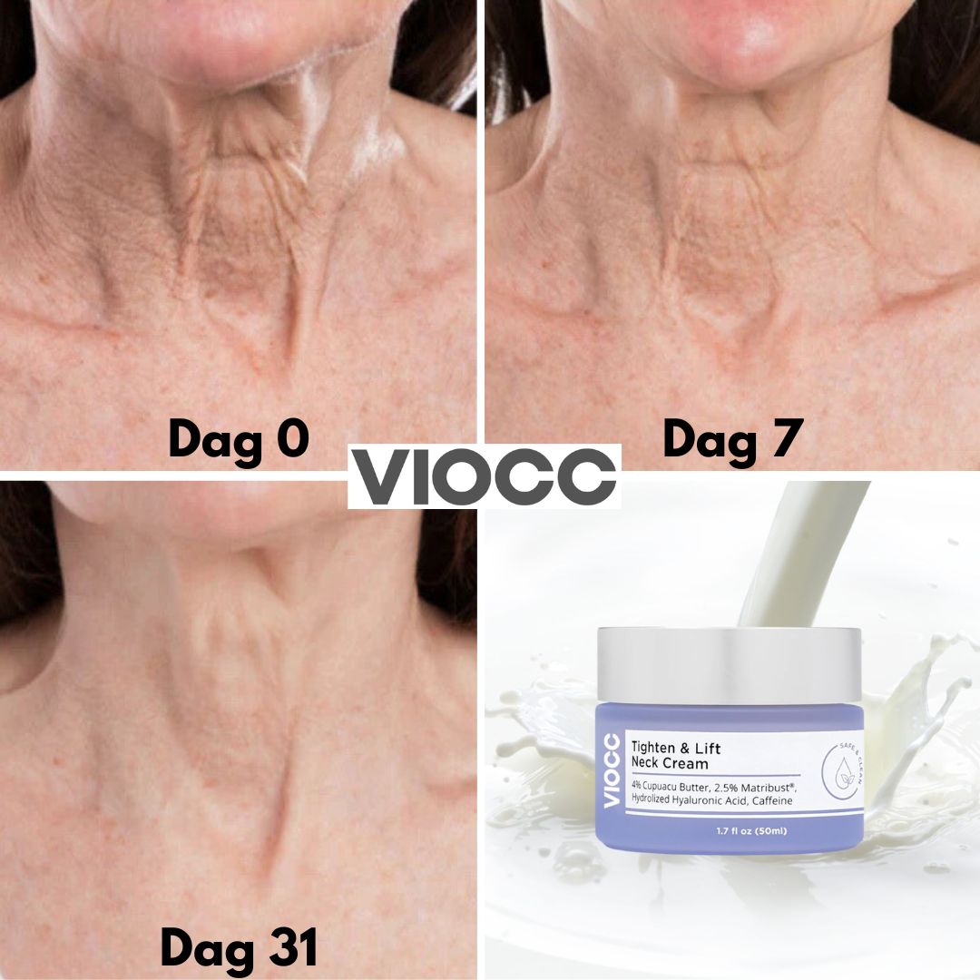 VIOCC™ Stram & Løft Nakekrem