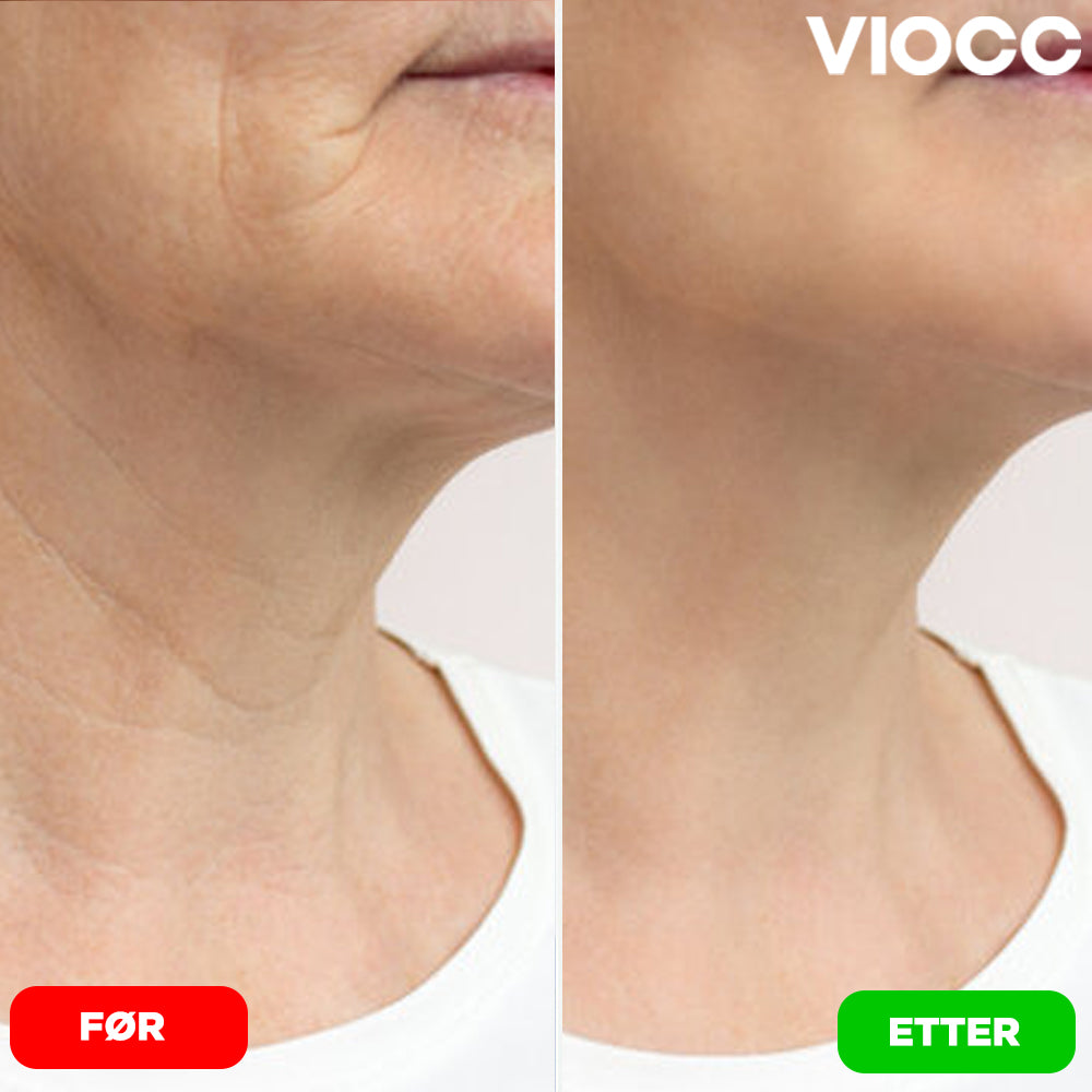 VIOCC™ Stram & Løft Nakekrem