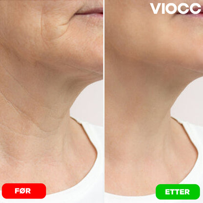 VIOCC™ Stram & Løft Nakekrem
