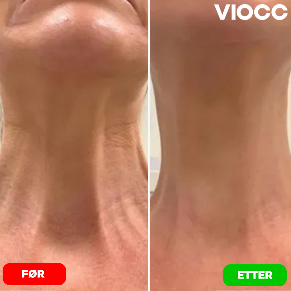 VIOCC™ Stram & Løft Nakekrem